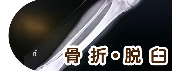 骨折・脱臼のイメージ