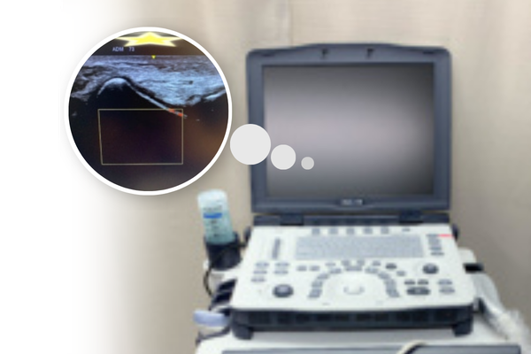 接骨院での検査イメージ