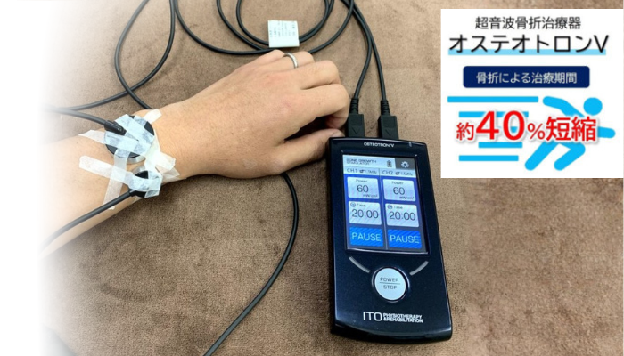 超音波治療器の使用イメージ